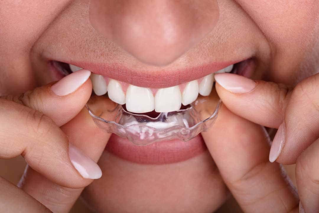 Treatment outcome image